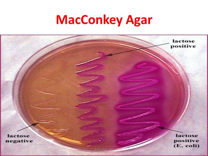 the structure of macconkey agar in a petri dish with labels on it