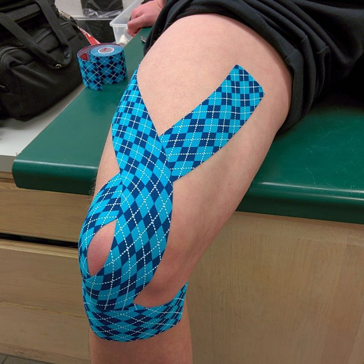 Rock Tape Technique for Anterior Knee Pain ~ Eat. Run. Rehabilitate. Knee Pain Remedies, Knee Taping, K Tape, Knee Pain Remedy, Kinesio Tape, Kt Tape, Tens Unit, Kinesio Taping, Lymph Massage