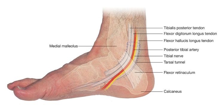 Image result for images of posterior tibial artery Tarsal Tunnel, Broken Ankle Recovery, Ankle Anatomy, Joints Anatomy, Ankle Ligaments, Ankle Fracture, Leg Anatomy, Foot Anatomy, Anatomy Bones