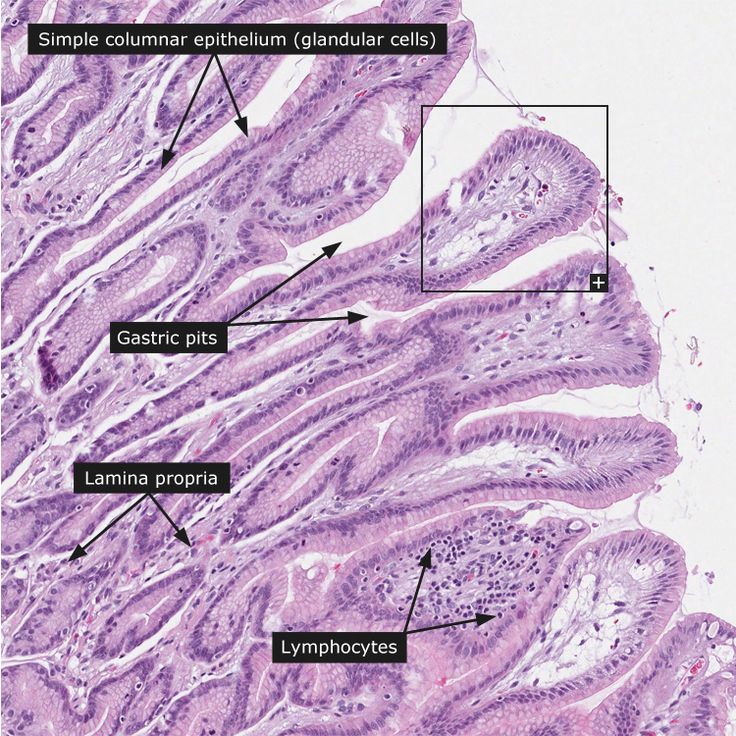 an image of the stomach with multiple sections labeled in blue and white, including lymphosoensys