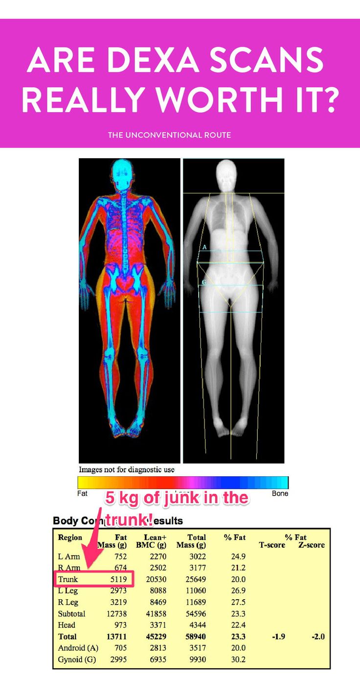 Dexa Scan Results, Bodybuilding Women Diet, Body Scan, Muscle Building Foods, Competition Prep, Diagnostic Imaging, Workout Routine For Men, Outdoor Workout, Fitness Plans