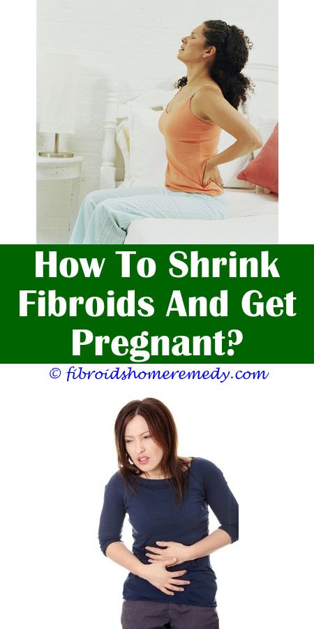 Pin on Can Fibroids Cause Weight Gain