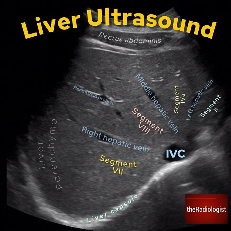 The Radiologist on Instagram: “LIVER ULTRASOUND⁣ ⁣ 👨🏽‍💻Ultrasound of ...