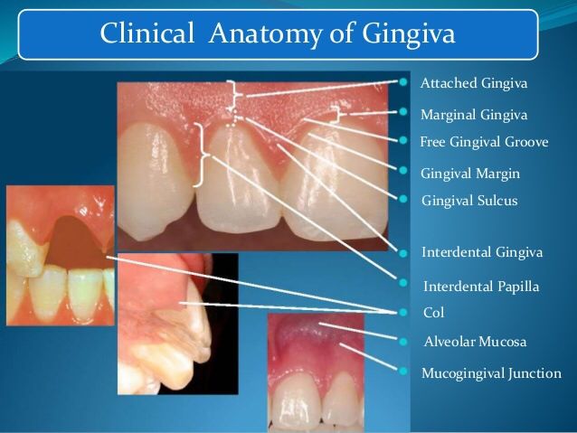 Gingival Anatomy Dental Assistant Study Guide, Dental Charting, Dental Assistant School, Dental Hygienist School, Dental Assistant Study, Dental Hygiene Student, Dental Aesthetics, Dental Hygiene School, Dentistry Student