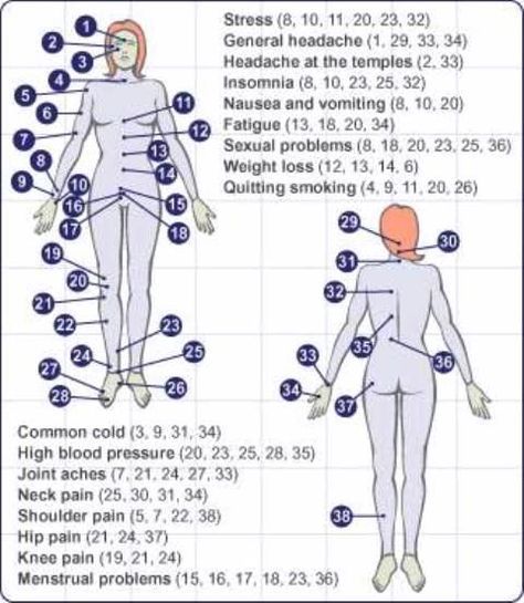 trigger points chart | Web site designed & hosted at Homestead™ Cupping Points, Acupressure Points Chart, Acupuncture Charts, Punkty Spustowe, Shiatsu Massage Acupressure, Acupuncture Benefits, Cupping Massage, Point Acupuncture, Reflexology Chart