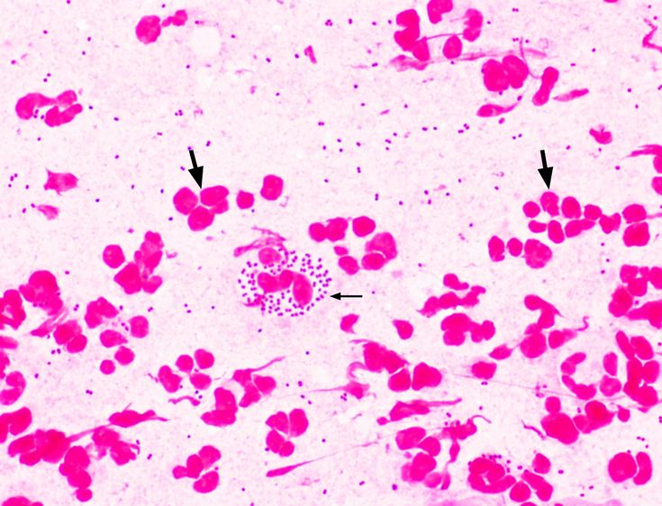 the cells in this cell are pink and red, with small black dots on them