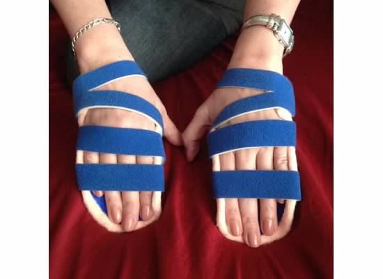 Dupuytren › Night splint for contracture | Forum for Dupuytren's contracture Dupuytren's Contracture, Geriatric Occupational Therapy, Ankle Strengthening Exercises, Disabled Women, Adaptive Equipment, Hand Exercises, Leg Braces, Hand Therapy, Strengthening Exercises