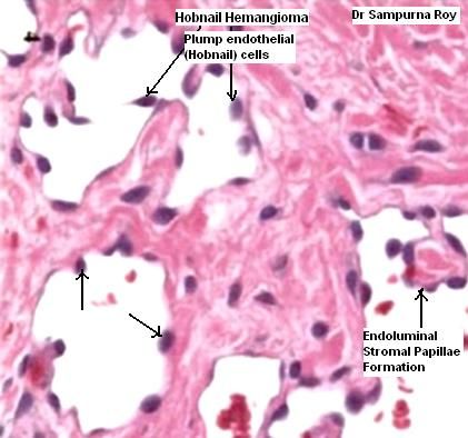 Pin on Systemic Pathology ; Medicine