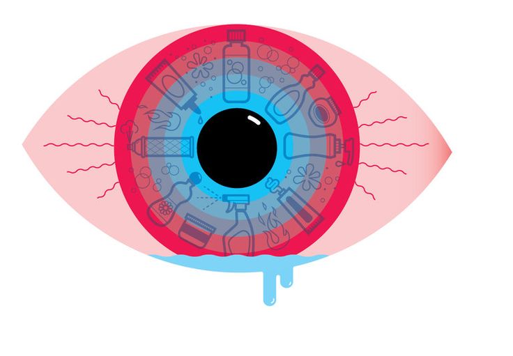 an eye with the iris opened to show all parts of the iris and its surrounding structure