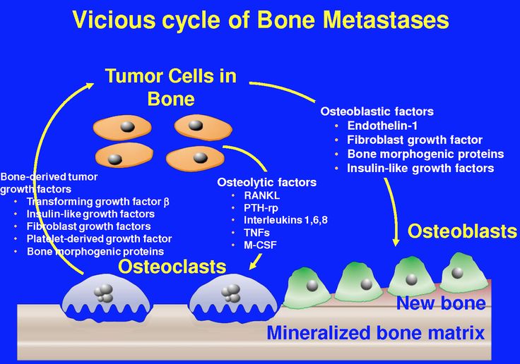 bone metastasis Growth Factor, Microbiology, My Dad, Nursing, Presentation, Health, Quotes