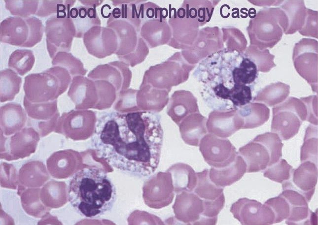 an image of blood cell morphody in purple and white colors with the words, blood cell morphophy case