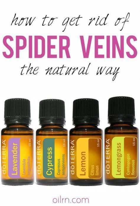 treat spider veins with essential oils by karen.x #EssentialOilsForPain - #essential #essentialoilsforpain #karen #karenx #oils #spider #treat #veins Terra Essential Oils, Doterra Oils Recipes, Varicose Vein Remedy, Doterra Oil, Doterra Essential Oils Recipes, Essential Oil Remedy, Essential Oils Guide, Oil Remedies, Essential Oils For Skin