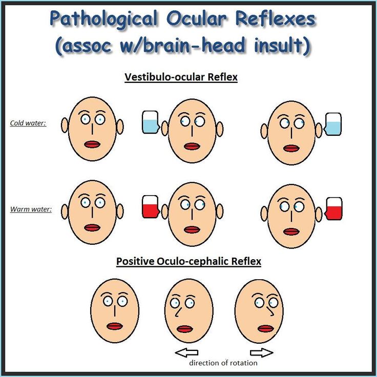 the stages of facial reflexs and their corresponding areas in which one person is able to see