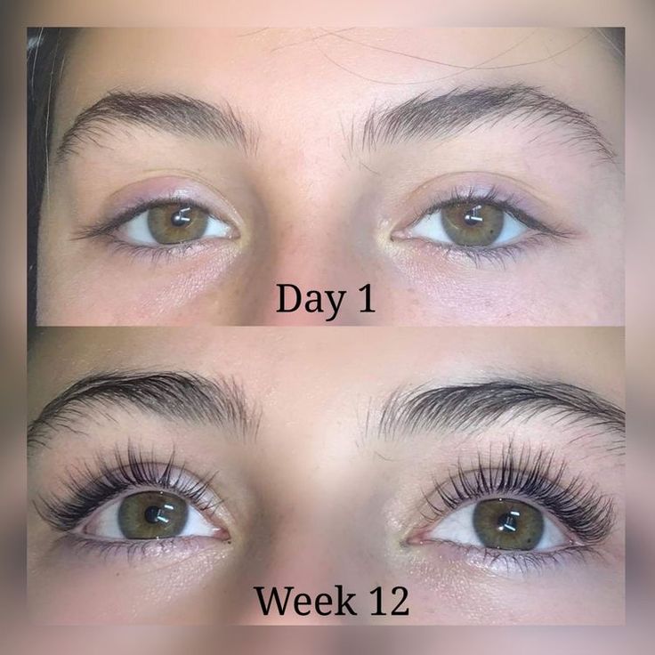 Amazing eyelash serum results before and after Brow Growth, Coffee Facial, Brow Growth Serum, Lash Growth Serum, Glowing Radiant Skin, How To Grow Eyelashes, Full Lashes, Eyelash Growth Serum, Home Remedies For Hair