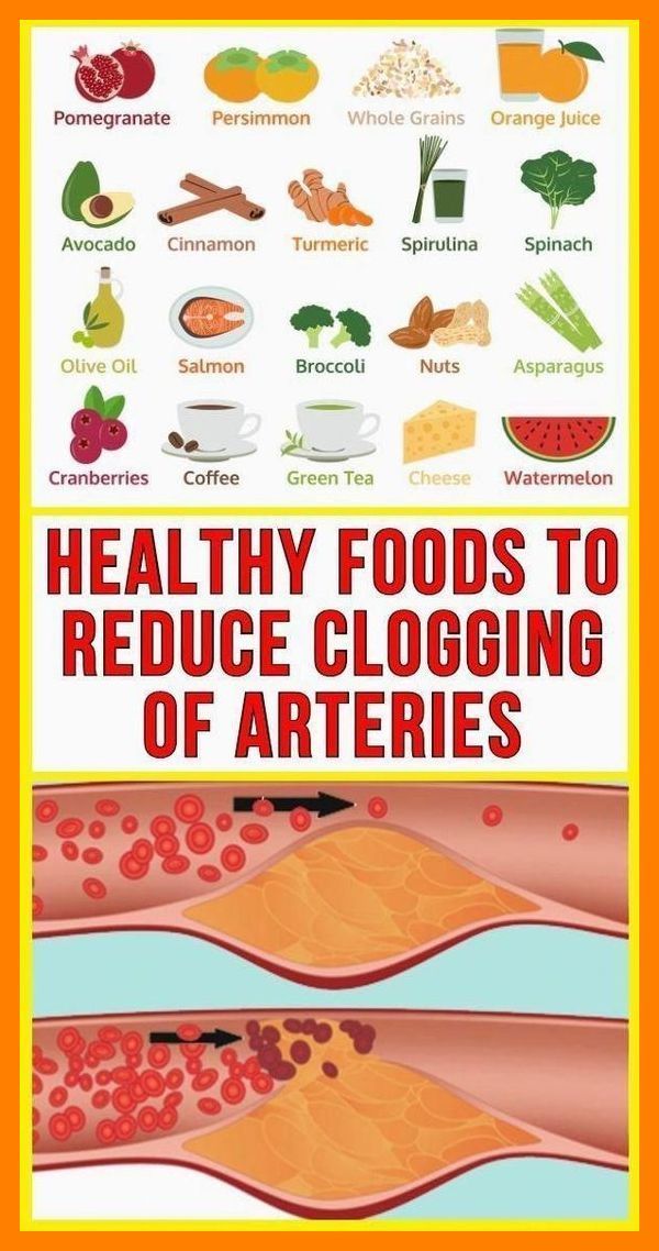 In the last few decades we have all witnessed to be full of heart issues and pressure, cholesterol, atherosclerosis. These are coming from unhealthy diet and no moving. And they can even be deadly. Natural Dandruff Remedy, Health Resolutions, Heart Healthy Diet, Unhealthy Diet, Resep Diet, Low Carb Diets, Heart Healthy Recipes, Idee Pasto Sano, Healthy Food Choices