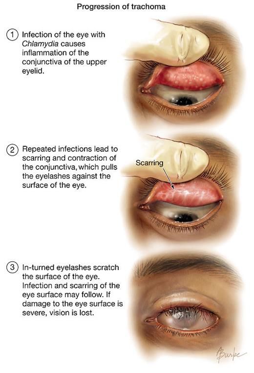 the stages of an eyeliding procedure with instructions on how to use it and what to do