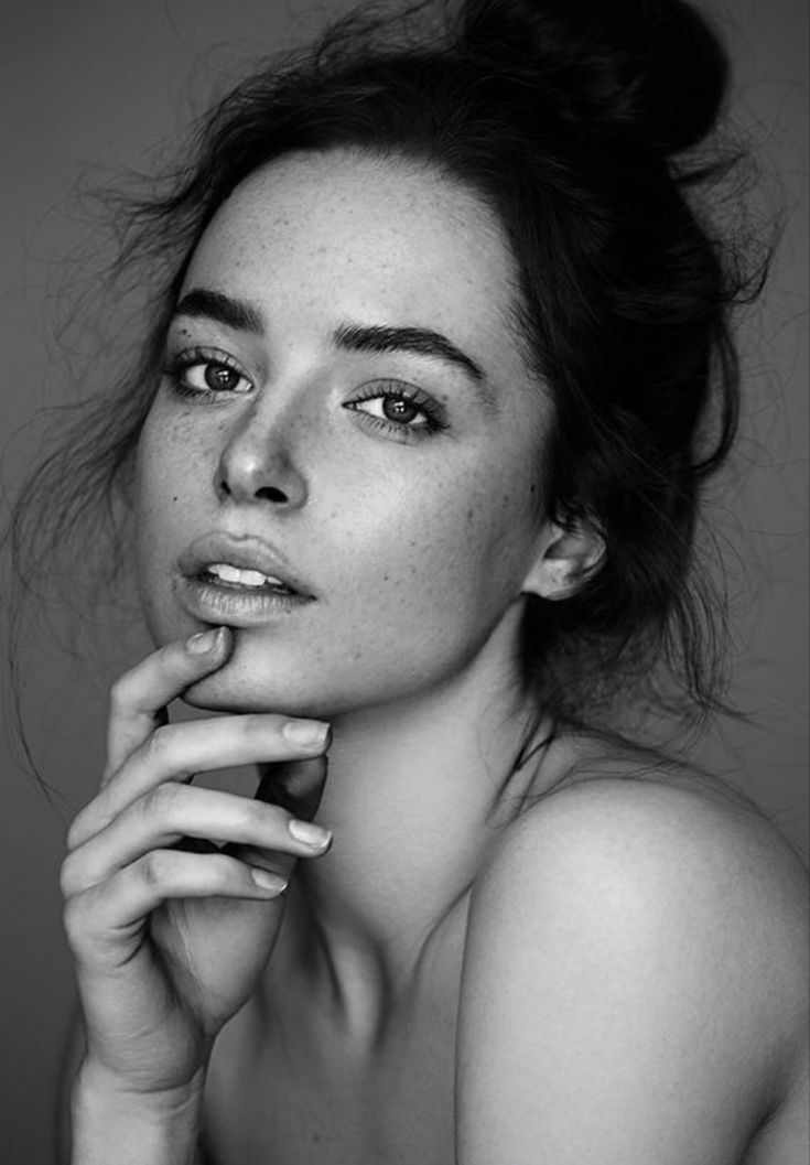 a black and white photo of a woman with freckles on her face looking at the camera