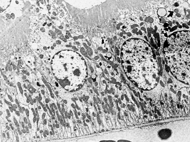 an animal's cell is shown in this black and white photo, with small dots on it