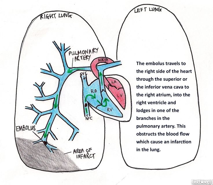 an image of two lungs with labels on them