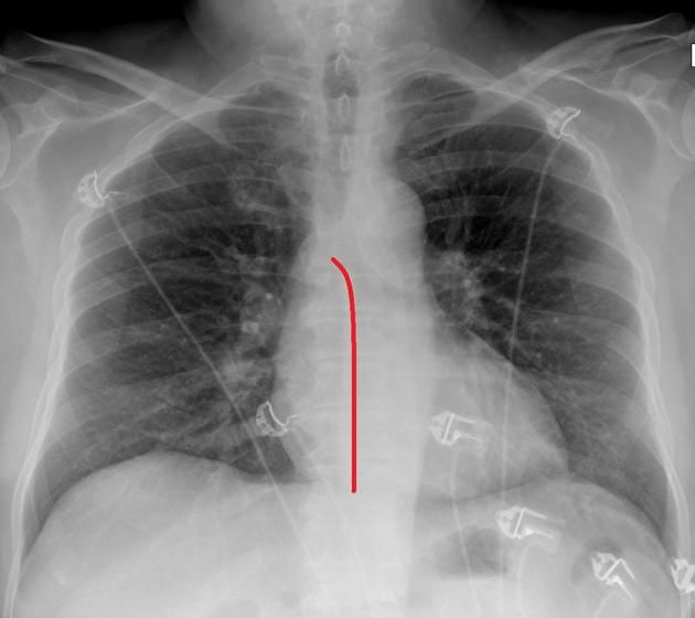 the chest is shown with an arrow pointing to it