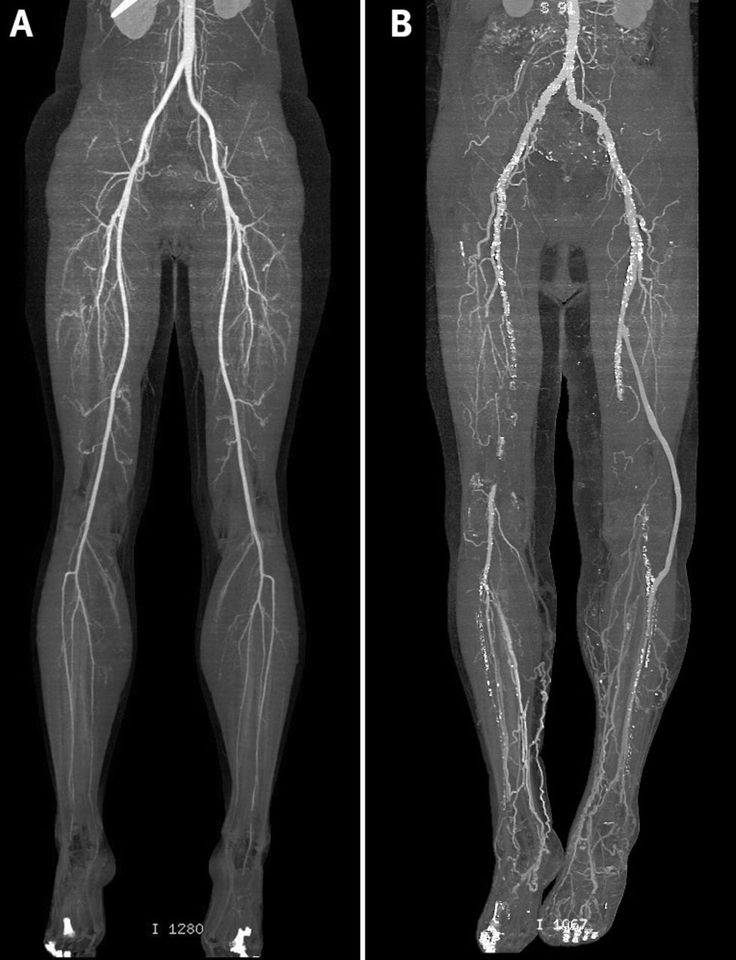 an x - ray shows the upper limb and lower limb, as well as the lower limb