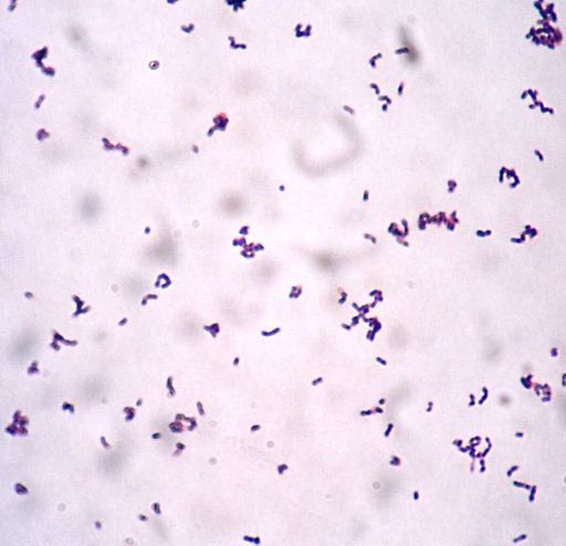 Hydrogen-oxidizing Bacteria – Definition, Characteristics and Examples ...