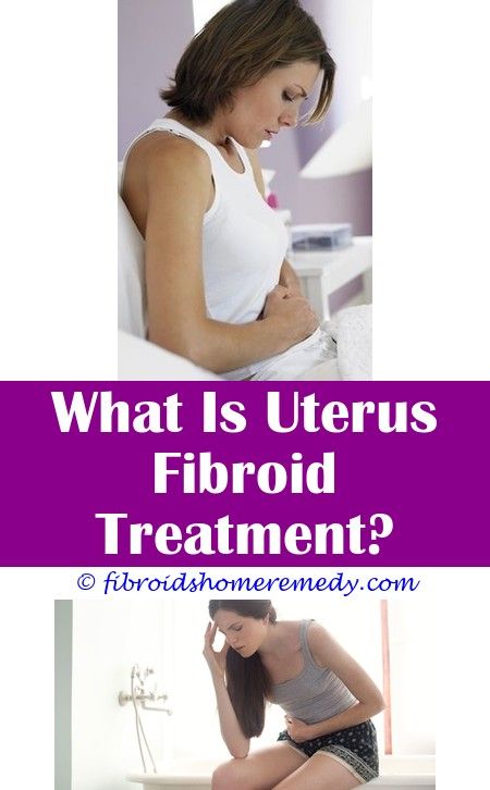 Can I Get Pregnant With Fibroids | Uterine fibroids treatment, Uterine ...