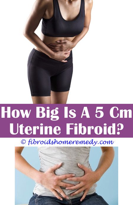 Pin on Fibroid Size