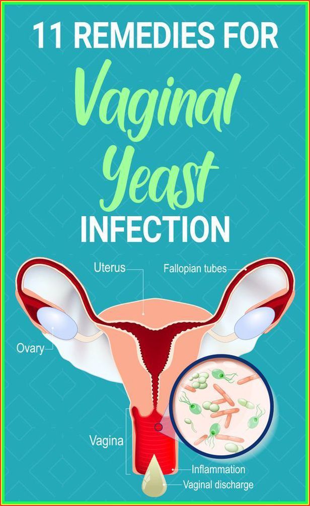 Check this out 11 best home remedies for yeast infection that actually work Home Remedies For Yeast Infection, Remedies For Yeast Infection, Fallopian Tubes, Health And Fitness Magazine, Natural Antibiotics, Healthy Diet Tips, Daily Health Tips, Fitness Advice, Healthy Eating Tips