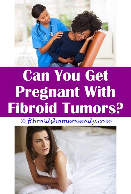 4 Cm Fibroid Outside Uterus | Fibroids, Uterine fibroids symptoms ...