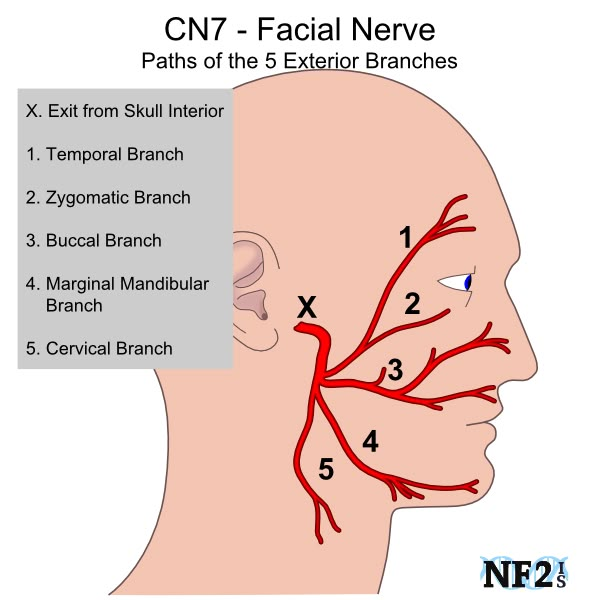 The facial nerve, or the seventh cranial nerve has both sensory and motor functions. For sensory, it is involved with taste on the anterior 2/3 portion of the tongue. For motor, is controls facial expressions, as well as tear, nasal, and palatine glands. Vestibulocochlear Nerve, Nerve Anatomy, Anatomy Head, Bells Palsy, Facial Nerve, Dental Anatomy, Facial Anatomy, Face Anatomy, Brain Anatomy