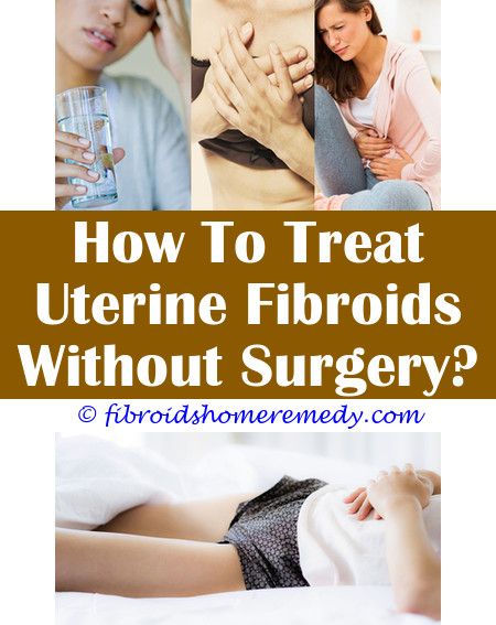 Pin on What Causes Uterine Fibroids