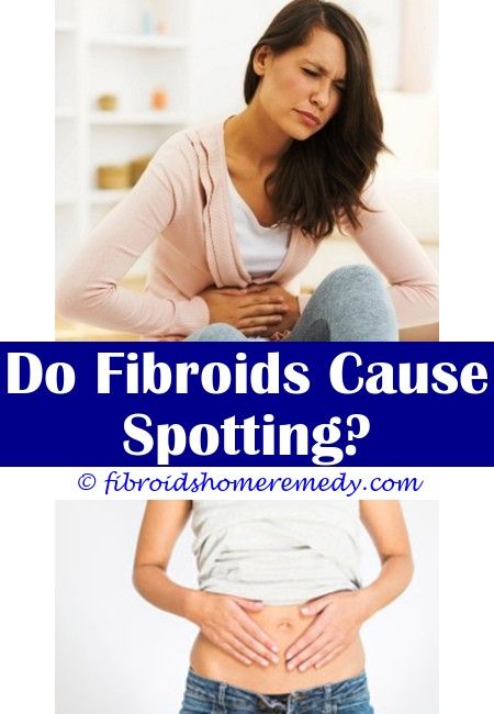 Pin on Fibroids And Weight Gain