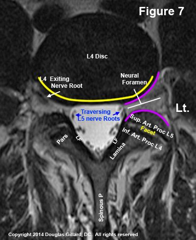 an x - ray shows the location of the head and neck in this mri image