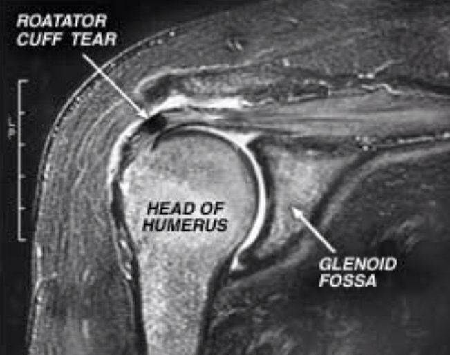 an x - ray image shows the location of the head and neck in this case