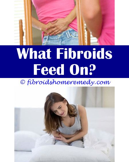 Foot Fibroids | Fibroids, Uterine fibroids, Fibroid cyst