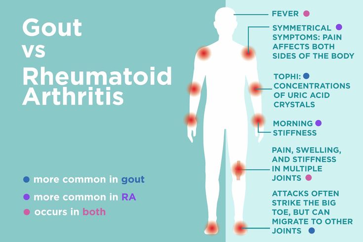 You Can Ease Inflammatory Arthritis Brain Fog with These 12 Tips for a Sharper Mind – CreakyJoints Focus Hacks, Ra Symptoms, Health Infographic, Uric Acid Levels, Brain Energy, Home Apothecary, Essential Oils For Pain, Brain Anatomy, Health Care Professionals