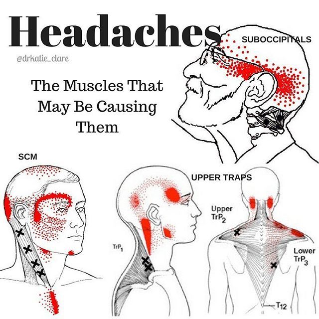 Tension Headaches💫 . Most of us are familiar with tension headaches ...