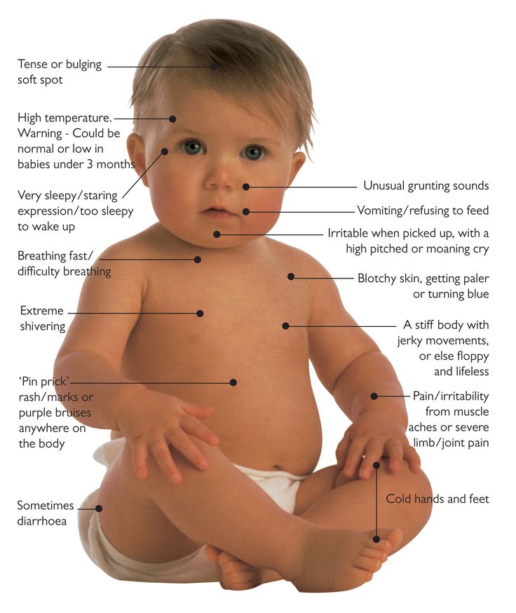 Common disease in new born, infants that you should take care of your child from these diseases. Toddler Cold, Very Sleepy, Childrens Health, Baby Center, Study Motivation Inspiration, Signs And Symptoms, Kids Health, Parenting Advice, Baby Care