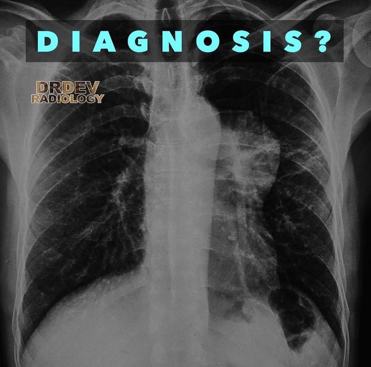 Dr. Dev on Instagram: “What is your diagnosis? . . . . . Anterior ...