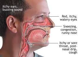 When the mucus in throat and phlegm in throat area after eating relates to foods sensitivity, you'll expertise some other signs and symptoms, for example asthma, hives, tingling inside your mouth area and also digestive signs and symptoms. Mucus In Throat, Summer Allergies, Lung Cleanse, Mold Exposure, Toxic Mold, Black Mold, Allergic Rhinitis, Itchy Throat, Oregano Oil