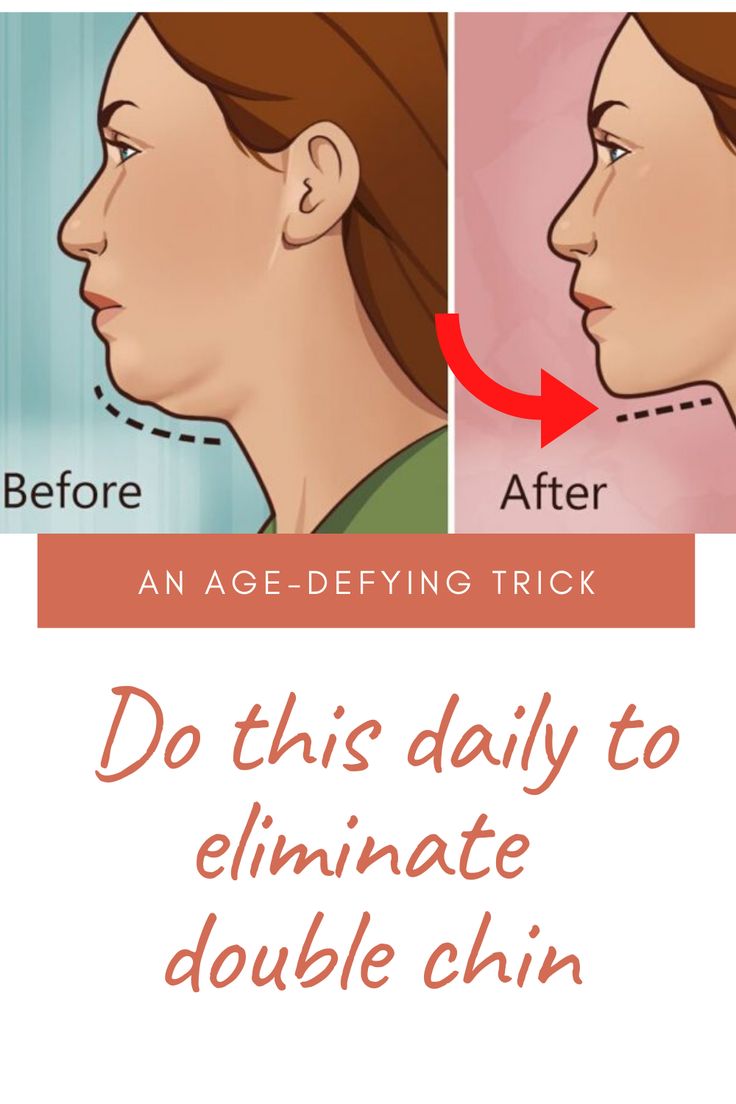 Doing this daily will eliminate loose skin and double chin in as little as 7 days. No cream needed. Rid Of Double Chin Fast, Rid Of Double Chin, Neckline Slimmer, Loose Skin, Double Chin, Age Defying, World's Best, Cream, Skin