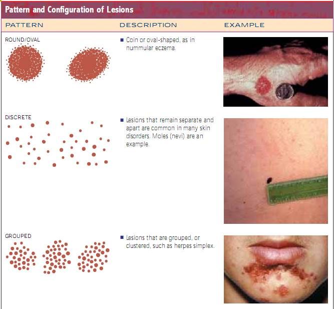 Lesions | Hair and nails, Skin, Nails