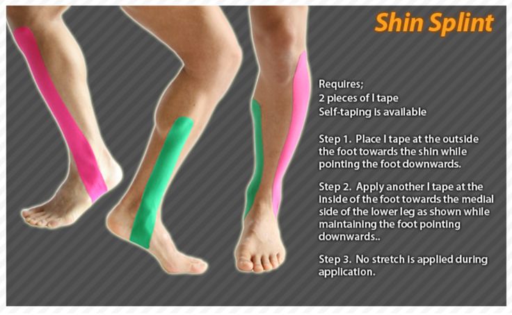 Kinesiology taping instructions for shint splints #ktape #ares #shinsplints Anterior Shin Splints, Shin Splint Exercises, K Tape, Physical Therapy Student, Kinesio Taping, Sports Therapy, Sports Tape, Ankle Pain, Kinesiology Taping