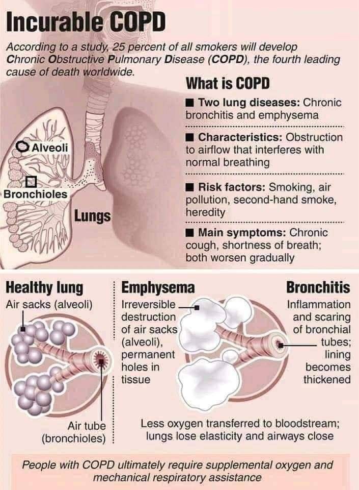 Pin by Carol Muller on heart info in 2021 | Chronic obstructive ...