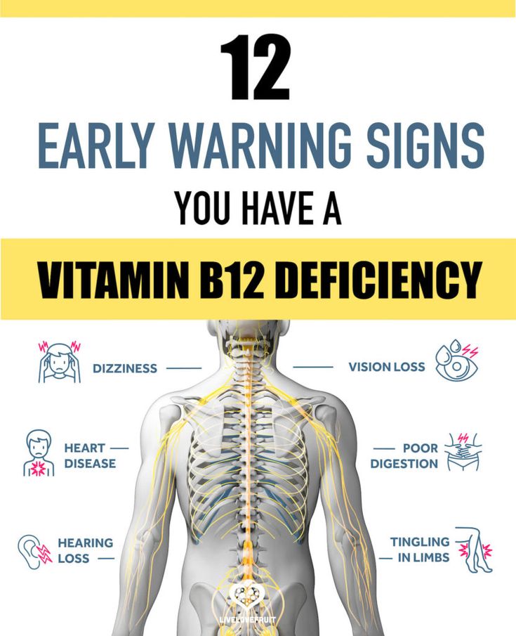 graphic of body with neural system with text - 12 early warning signs you have a vitamin b12 deficiency B12 Deficiency Symptoms, Health And Fitness For Women, Deficiency Symptoms, Vitamin B12 Deficiency, B12 Deficiency, Health Women, Vitamin Deficiency, Fitness For Women, Nutritional Deficiencies