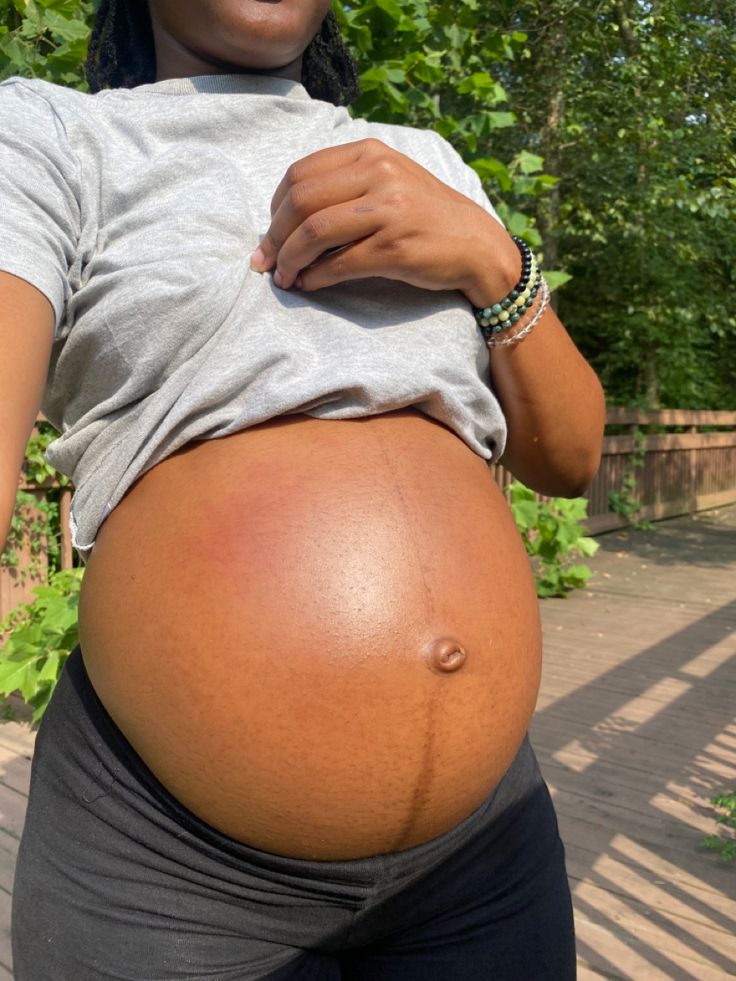 Pregnant Belly Black Women, Black Pregnant Belly, Pregnancy Black Women, Black Woman Pregnant, 3 Months Pregnant Belly, Black Women Pregnant, Black Pregnant Women, Pregnant Baddie, Pregnant Black Women