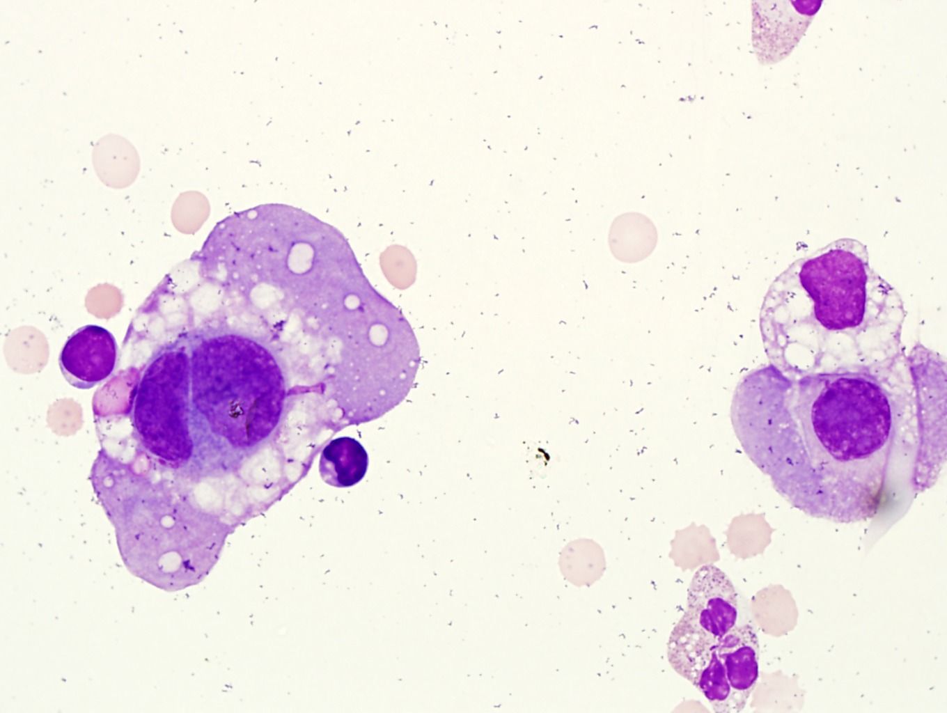 Mesothelial Cells