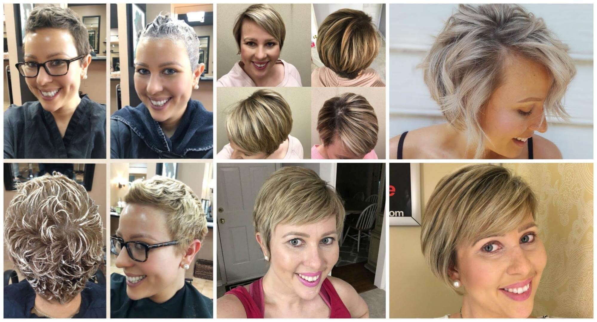 Hairstyles After Chemo Hair Loss Hair Styles Ideas