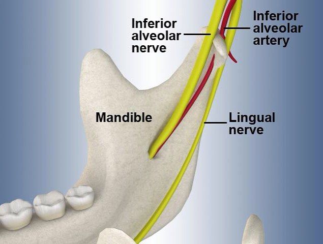 Landmarks For Inferior Alveolar Nerve Block